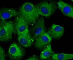 Invitrogen CRMP2 Polyclonal Antibody 100 &mu;L; Unconjugated:Antibodies,