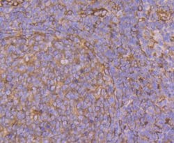 Invitrogen CRMP2 Polyclonal Antibody 100 &mu;L; Unconjugated:Antibodies,