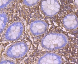 Invitrogen CRMP2 Polyclonal Antibody 100 &mu;L; Unconjugated:Antibodies,