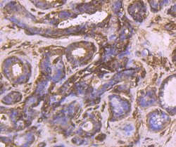 Invitrogen CRMP2 Polyclonal Antibody 100 &mu;L; Unconjugated:Antibodies,