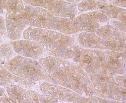 Invitrogen ApoC3 Polyclonal Antibody 100 &mu;L; Unconjugated:Antibodies,