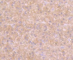 Invitrogen GOT1 Polyclonal Antibody 100 &mu;L | Buy Online | Invitrogen&trade; | Fisher Scientific