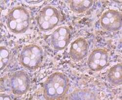 Invitrogen GOT1 Polyclonal Antibody 100 &mu;L | Buy Online | Invitrogen&trade; | Fisher Scientific