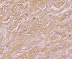 Invitrogen GOT1 Polyclonal Antibody 100 &mu;L | Buy Online | Invitrogen&trade; | Fisher Scientific