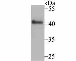 Invitrogen GOT1 Polyclonal Antibody 100 &mu;L | Buy Online | Invitrogen&trade; | Fisher Scientific