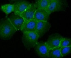 Invitrogen TROP2 Polyclonal Antibody 100 &mu;L; Unconjugated:Antibodies,
