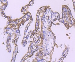 Invitrogen TROP2 Polyclonal Antibody 100 &mu;L; Unconjugated:Antibodies,
