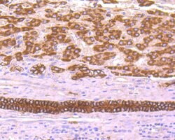 Invitrogen TROP2 Polyclonal Antibody 100 &mu;L; Unconjugated:Antibodies,