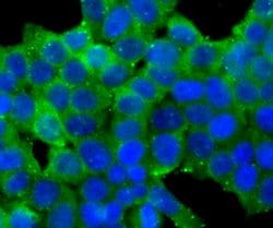 Invitrogen Carbonic anhydrase II Polyclonal Antibody 100 &mu;L; Unconjugated:Antibodies,