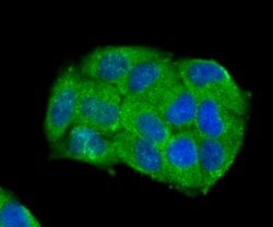 Invitrogen Carbonic anhydrase II Polyclonal Antibody 100 &mu;L; Unconjugated:Antibodies,
