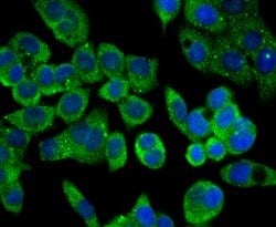 Invitrogen Carbonic anhydrase II Polyclonal Antibody 100 &mu;L; Unconjugated:Antibodies,