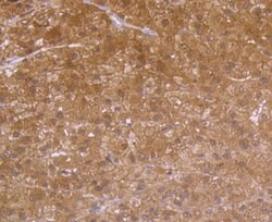 Invitrogen Carbonic anhydrase II Polyclonal Antibody 100 &mu;L; Unconjugated:Antibodies,