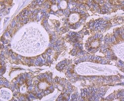 Invitrogen Carbonic anhydrase II Polyclonal Antibody 100 &mu;L; Unconjugated:Antibodies,