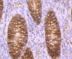 Invitrogen Carbonic anhydrase II Polyclonal Antibody 100 &mu;L; Unconjugated:Antibodies,