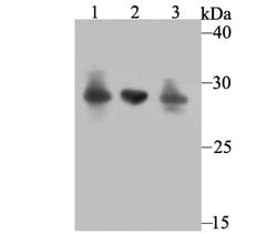 Invitrogen Carbonic anhydrase II Polyclonal Antibody 100 &mu;L; Unconjugated:Antibodies,