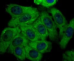 Invitrogen Kir3.4 (KCNJ5) Polyclonal Antibody 100 μL; Unconjugated:Antibodies,