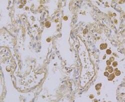 Invitrogen Kir3.4 (KCNJ5) Polyclonal Antibody 100 μL; Unconjugated:Antibodies,