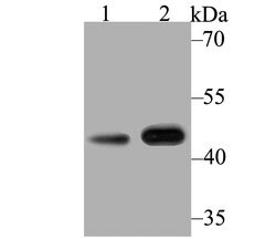 Invitrogen Kir3.4 (KCNJ5) Polyclonal Antibody 100 μL; Unconjugated:Antibodies,