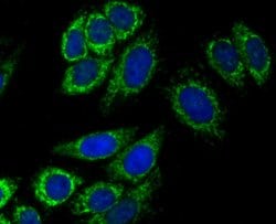 Invitrogen alpha-1 Microglobulin Polyclonal Antibody 100 &mu;L | Buy Online | Invitrogen&trade; | Fisher Scientific