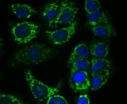 Invitrogen alpha-1 Microglobulin Polyclonal Antibody 100 &mu;L | Buy Online | Invitrogen&trade; | Fisher Scientific