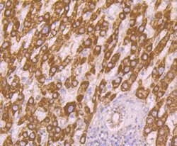 Invitrogen alpha-1 Microglobulin Polyclonal Antibody 100 &mu;L | Buy Online | Invitrogen&trade; | Fisher Scientific