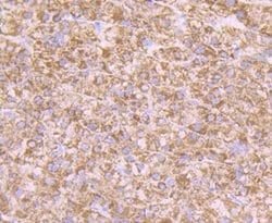 Invitrogen alpha-1 Microglobulin Polyclonal Antibody 100 &mu;L | Buy Online | Invitrogen&trade; | Fisher Scientific