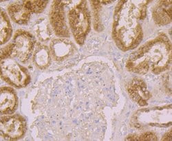 Invitrogen alpha-1 Microglobulin Polyclonal Antibody 100 &mu;L | Buy Online | Invitrogen&trade; | Fisher Scientific