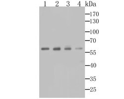 Invitrogen alpha-1 Microglobulin Polyclonal Antibody 100 &mu;L | Buy Online | Invitrogen&trade; | Fisher Scientific