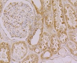 Invitrogen Calnexin Polyclonal Antibody 100 &mu;L; Unconjugated:Antibodies,