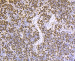 Invitrogen Prolactin Polyclonal Antibody 100 &mu;L; Unconjugated:Antibodies,