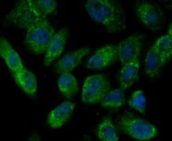 Invitrogen ILK Polyclonal Antibody 100 &mu;L; Unconjugated:Antibodies,