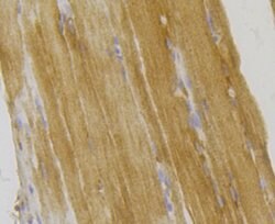 Invitrogen ILK Polyclonal Antibody 100 &mu;L; Unconjugated:Antibodies,