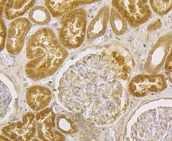 Invitrogen ILK Polyclonal Antibody 100 &mu;L; Unconjugated:Antibodies,
