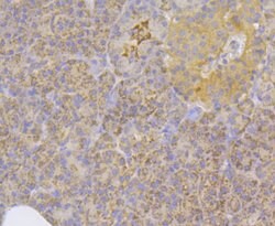 Invitrogen ILK Polyclonal Antibody 100 &mu;L; Unconjugated:Antibodies,
