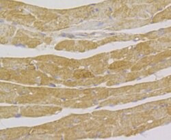 Invitrogen ILK Polyclonal Antibody 100 &mu;L; Unconjugated:Antibodies,