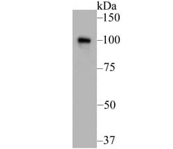 Invitrogen MSH2 Polyclonal Antibody 100 &mu;L; Unconjugated:Antibodies,