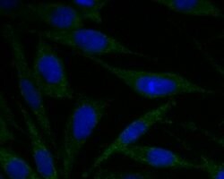 Invitrogen ACADM Polyclonal Antibody 100 &mu;L; Unconjugated:Antibodies,