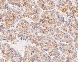 Invitrogen ACADM Polyclonal Antibody 100 &mu;L; Unconjugated:Antibodies,