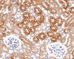 Invitrogen ACADM Polyclonal Antibody 100 &mu;L; Unconjugated:Antibodies,