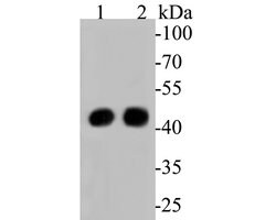 Invitrogen ACADM Polyclonal Antibody 100 &mu;L; Unconjugated:Antibodies,