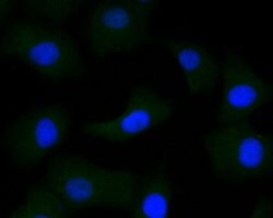Invitrogen DOG-1 Polyclonal Antibody 100 &mu;L; Unconjugated:Antibodies,