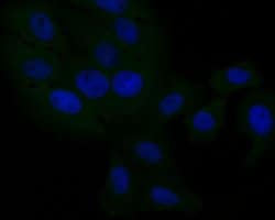 Invitrogen DOG-1 Polyclonal Antibody 100 &mu;L; Unconjugated:Antibodies,