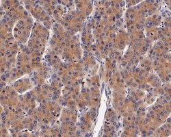Invitrogen DOG-1 Polyclonal Antibody 100 &mu;L; Unconjugated:Antibodies,