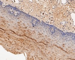 Invitrogen&trade;&nbsp;P2X2 Polyclonal Antibody