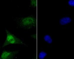 Invitrogen MCM7 Polyclonal Antibody 100 &mu;L | Buy Online | Invitrogen&trade; | Fisher Scientific
