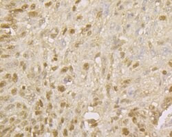 Invitrogen MCM7 Polyclonal Antibody 100 &mu;L | Buy Online | Invitrogen&trade; | Fisher Scientific