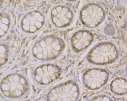 Invitrogen MCM7 Polyclonal Antibody 100 &mu;L | Buy Online | Invitrogen&trade; | Fisher Scientific