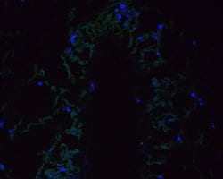 Invitrogen DWARF 14 Polyclonal Antibody 100 μL; Unconjugated:Antistoffer