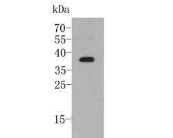 Invitrogen DWARF 14 Polyclonal Antibody 100 μL; Unconjugated:Antistoffer