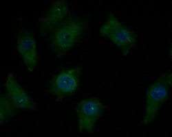 Invitrogen CHRNB2 Polyclonal Antibody 100 &mu;L; Unconjugated:Antibodies,